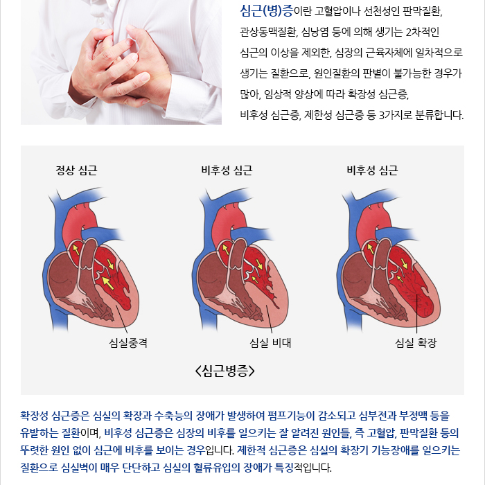 서울아산병원 심장병원 건강정보