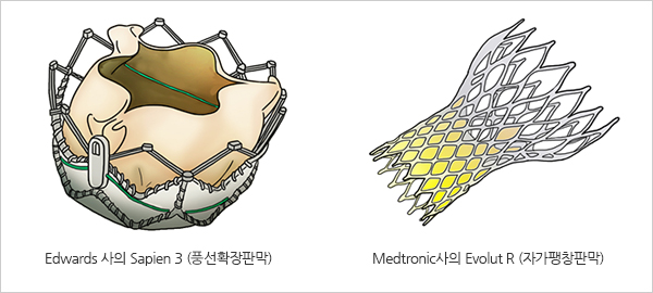 이뇨제 (Diuretics)