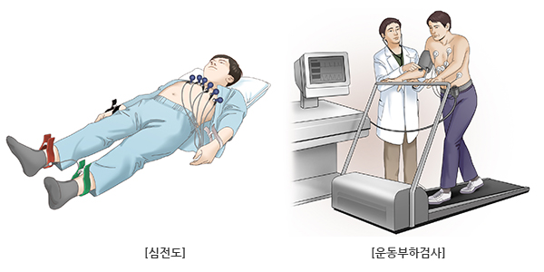 관상동맥질환