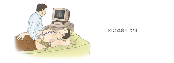 관상동맥질환