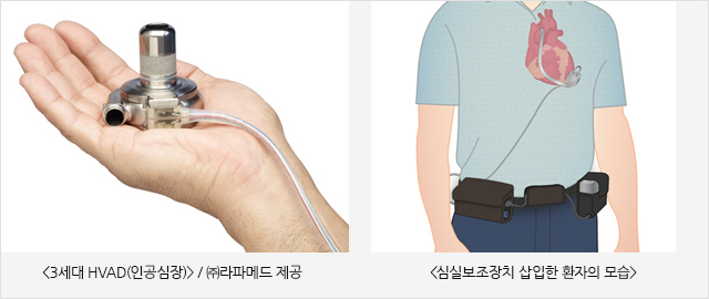 그림 2. 한국 2형 당뇨병에서 심혈관 질환의 유병률 / (출처: Diabetes Fact Sheet in Korea 2015, 대한당뇨병학회)