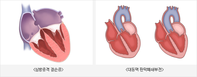 그림 2. 한국 2형 당뇨병에서 심혈관 질환의 유병률 / (출처: Diabetes Fact Sheet in Korea 2015, 대한당뇨병학회)