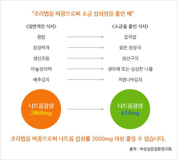 심방세동의 심전도 파형