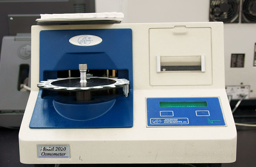 Osmometer 임상화학장비 장비소개 진단검사의학과소개 진단검사의학과 서울아산병원