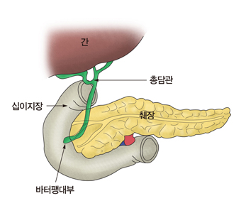 간 십이지장 총담관 췌장 버터팽대부의 위치