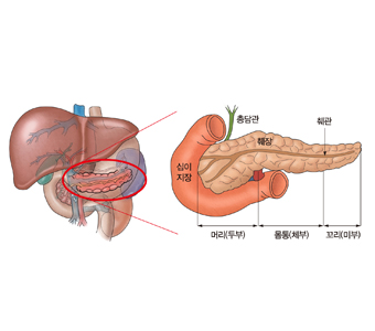 십이지장 총담관 췌장 췌관 머리(두부) 몸통(체부) 꼬리(마부)의 위치를 표시한 예시및 췌장의 위치