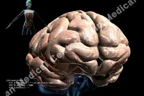 뇌의 모습 사진 예시
