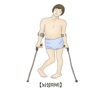 뇌성마비-뇌성마비에 걸려 목발에 의지한 체 서있는 남성
