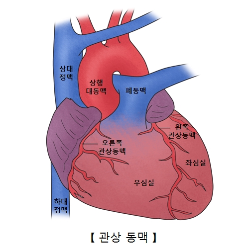 상대정맥 상행대동맥 폐동맥 하대정맥 오른쪽 관상동맥 우심실 왼쪽 관상동맥 좌심실의 위치와 관상동맥의 예시
