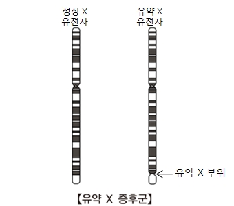 유약X증후군-정상X유전자와 유약X유전자(유약X부위표시) 그림 예시