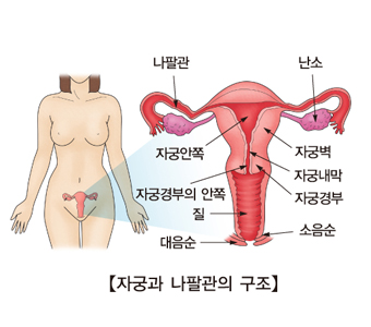 자궁의 비염증성 장애