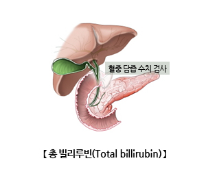 총빌리루빈