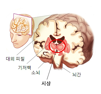 신상파괴술