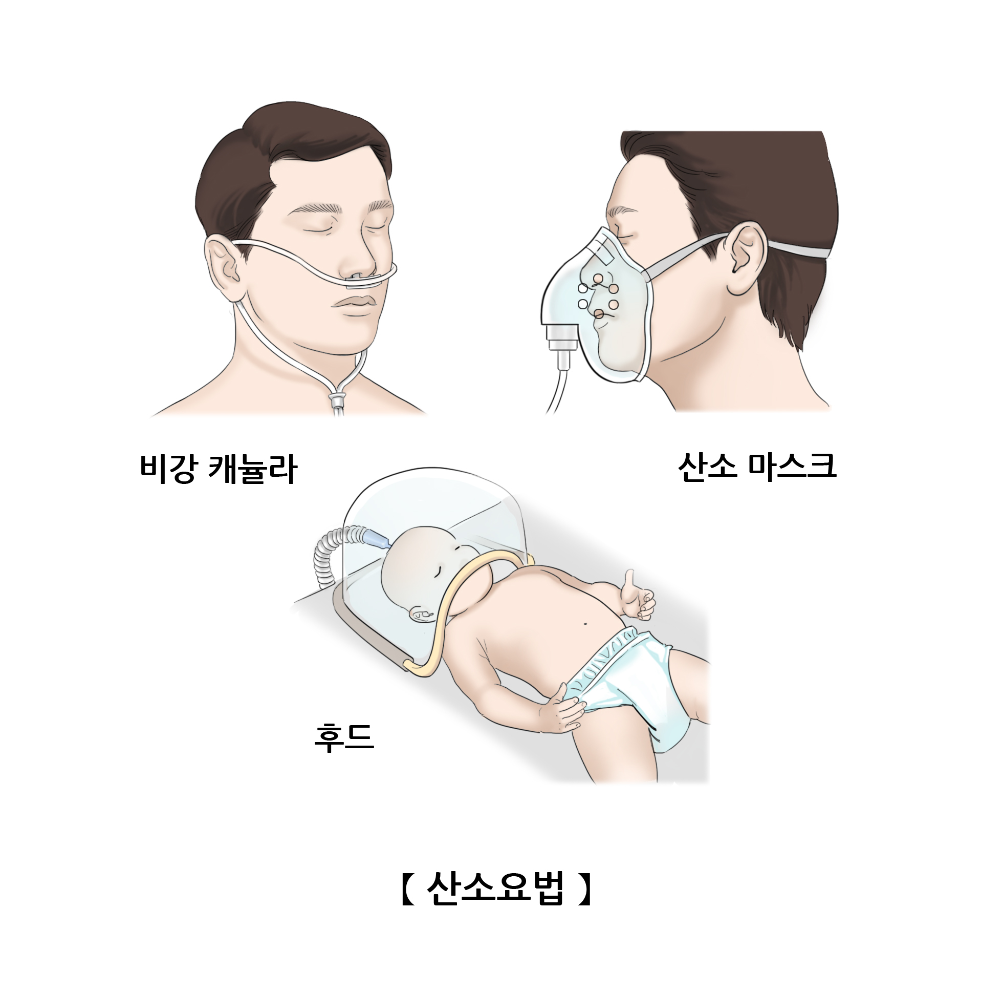 산소요법