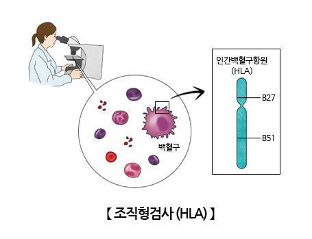 조직형검사