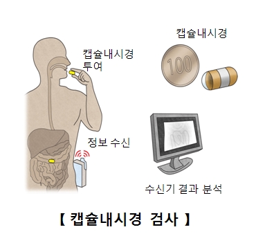 캡슐내시경 검사