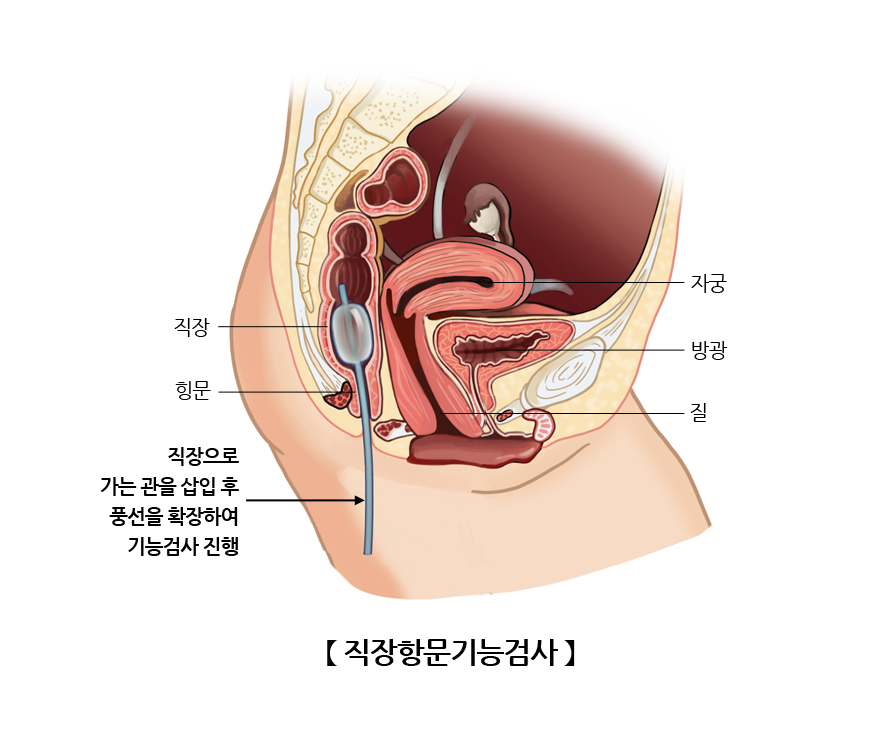 직장항문기능검사