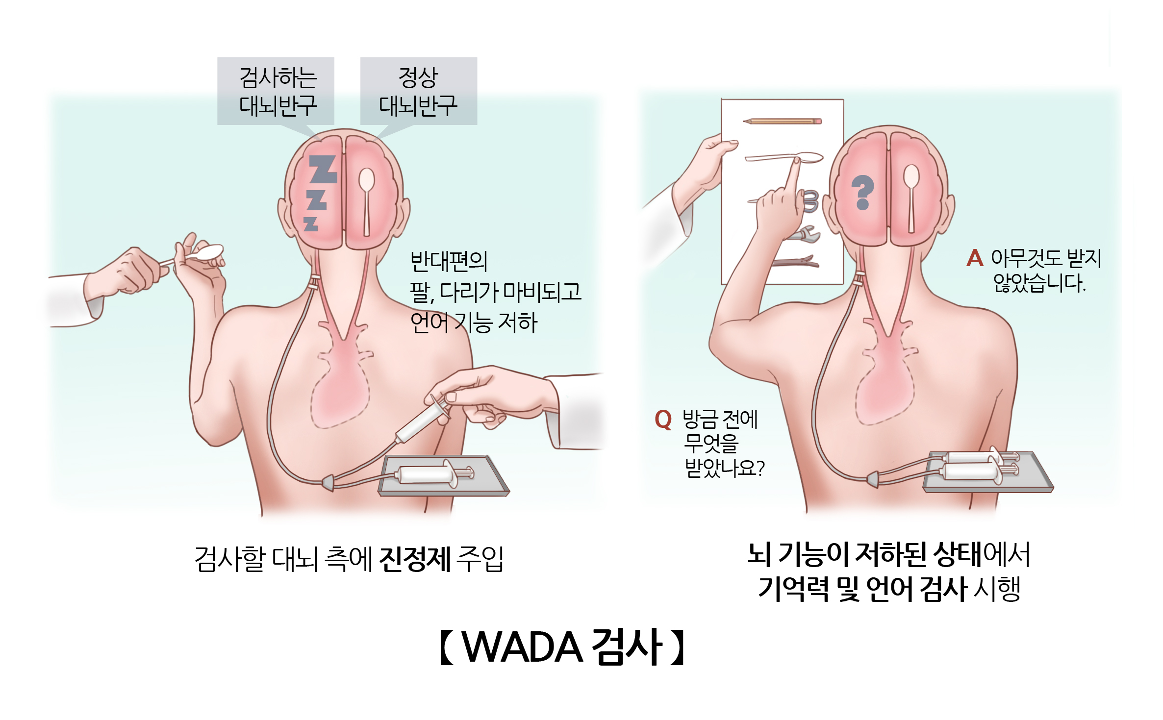 WADA 검사