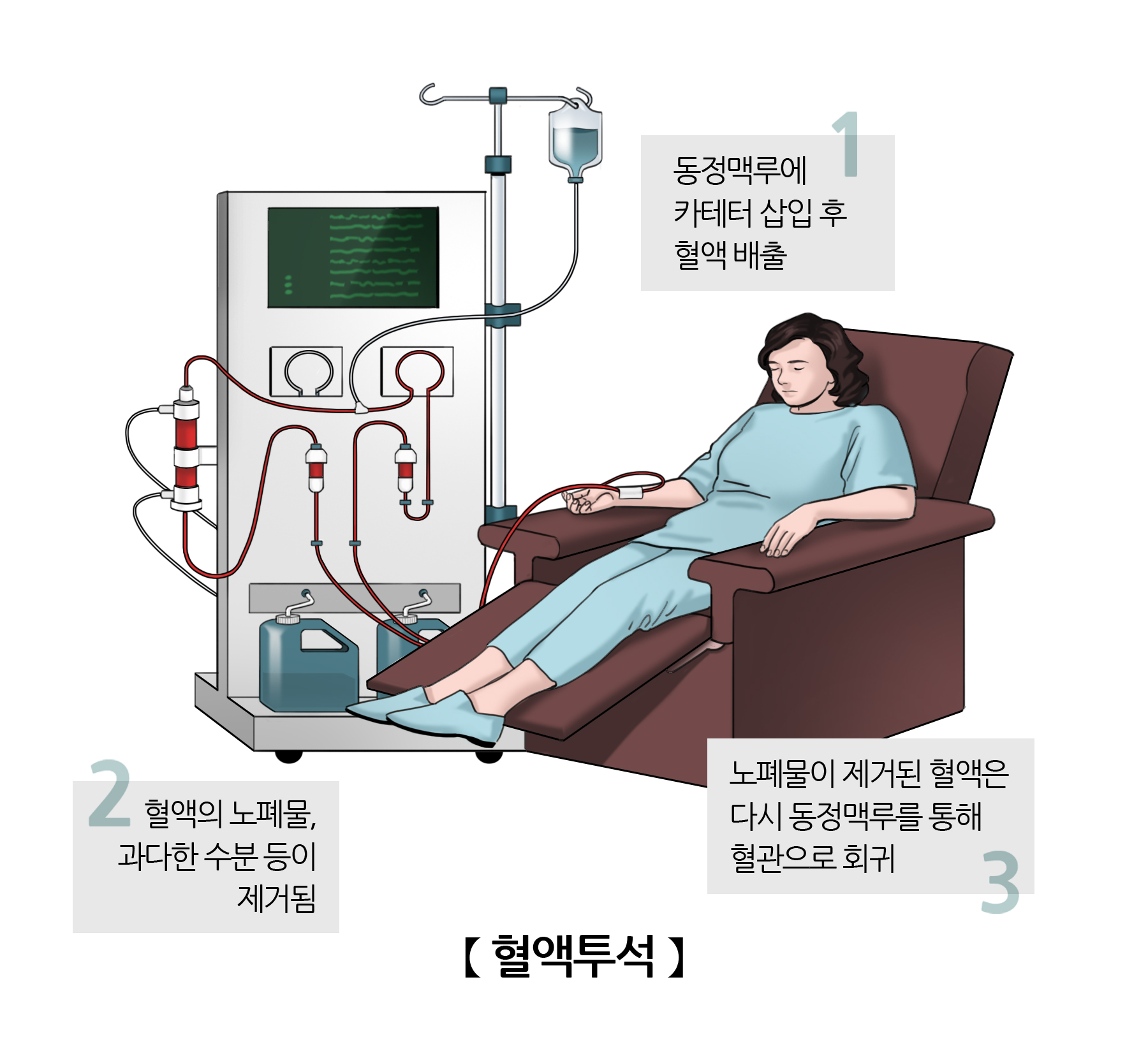 혈액투석