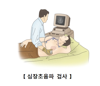 심장초음파 검사