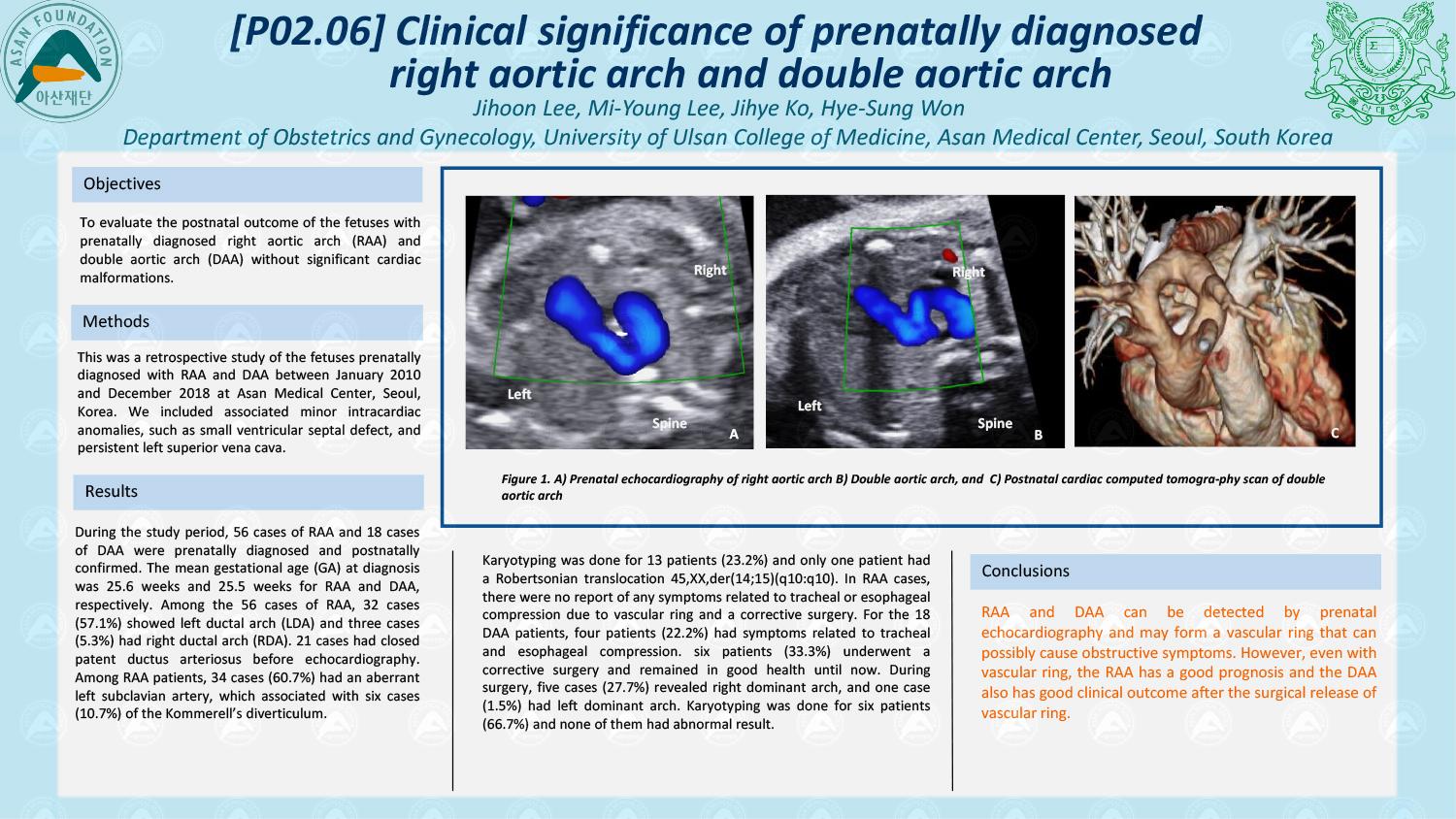 Clinical significance of prenatally diagnosed right aortic arch and double aortic arc