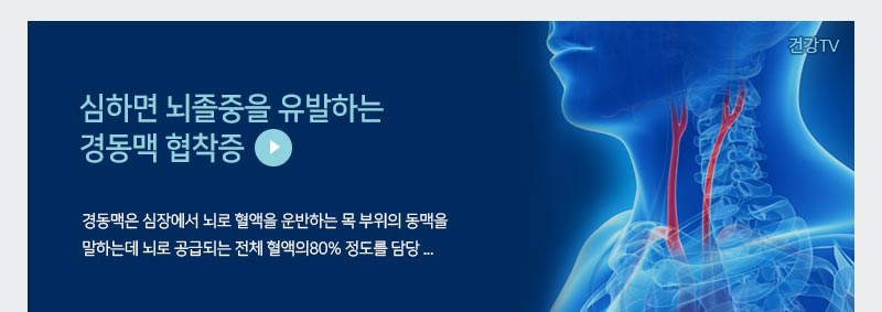 심하면 뇌졸증을 유발하는 경동맥 협착증