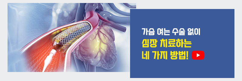 가슴을 열지 않고 심장 치료하는 네 가지 방법!