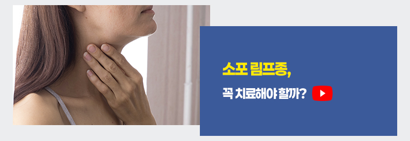 소포 림프종, 꼭 치료해야 할까?