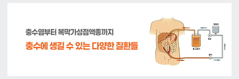 충수염부터 복막가성점액종까지 충수에 생길 수 있는 다양한 질환들