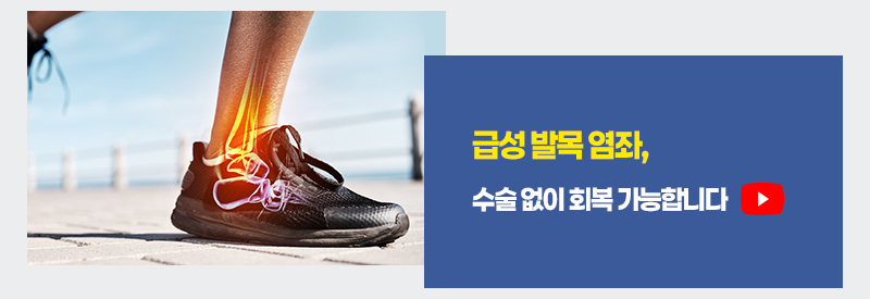 급성 발목 염좌, 수술 없이 회복 가능합니다