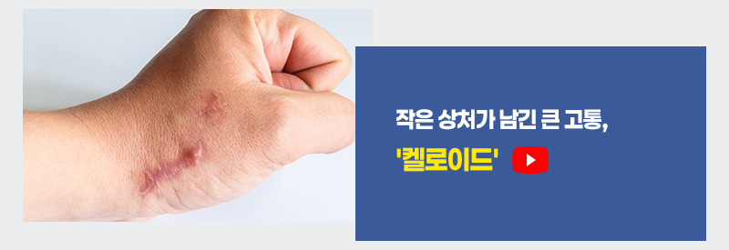 작은 상처가 남긴 큰 고통, 켈로이드