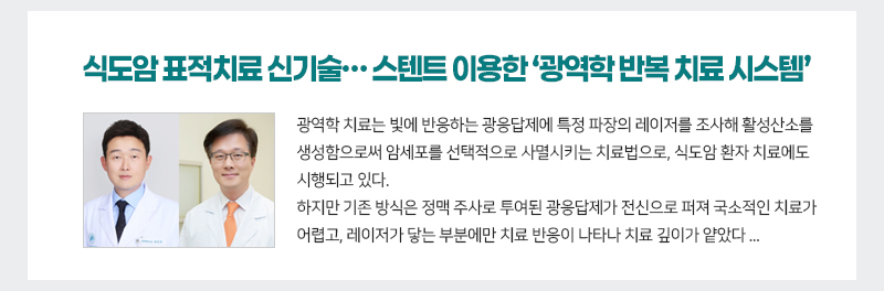 식도암 표적치료 신기술… 스텐트 이용한 ‘광역학 반복 치료 시스템’ 개발