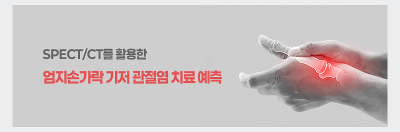 SPECT/CT를 활용한 엄지손가락 기저 관절염 치료 예측
