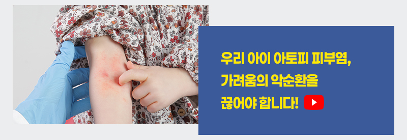 아토피 피부염, 가려움의 악순환을 끊어야 합니다!