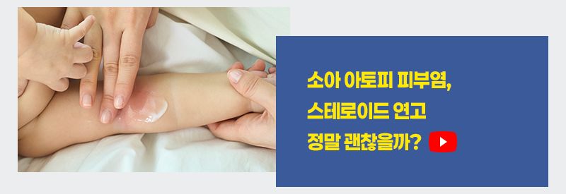 소아 아토피 피부염, 스테로이드 연고 정말 괜찮을까?
