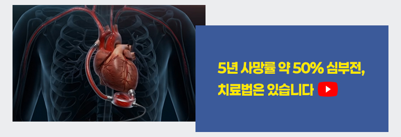 5년 사망률 약 50% 심부전, 치료법은 있습니다