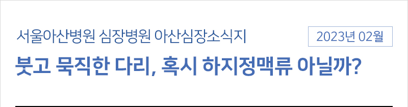 서울아산병원 심장병원 2월 아산심장소식지 [붓고 묵직한 다리, 혹시 하지정맥류 아닐까?]
