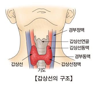 갑상선 결절 사이즈의 증상에 따라 치료가 달라지므로