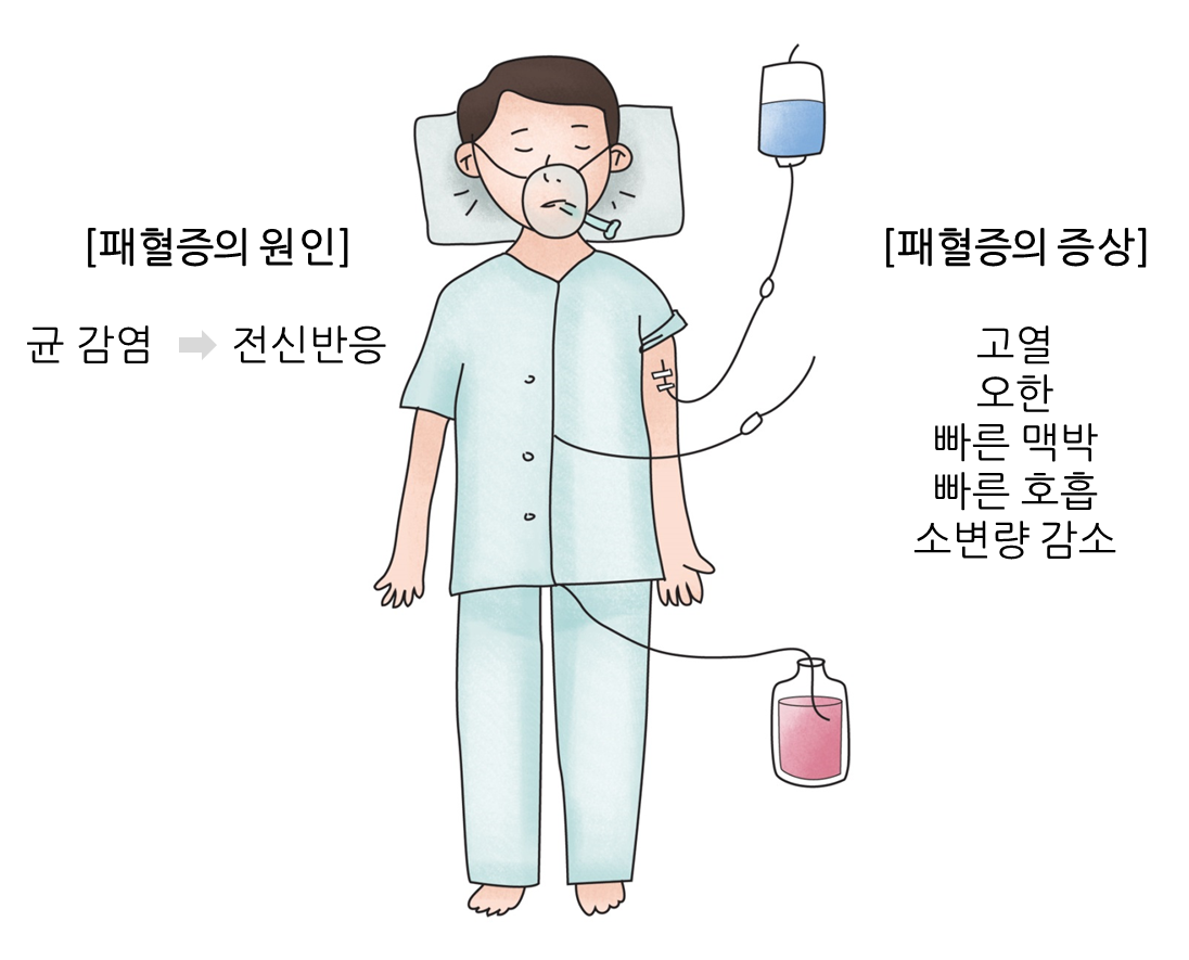 패혈증의 증상과 원인/급성 패혈증의 증상 5