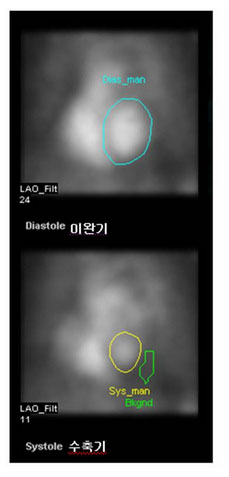 정상 삼박출율을 보이는 영상 사진 예시