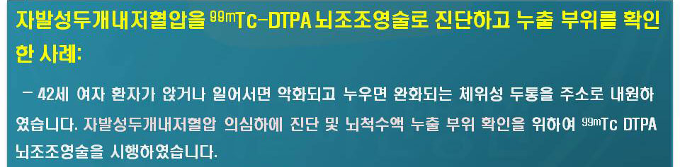 42세 여자 환자가 앉거나 일어서면 악화되고 누우면 완화되는 체위성 두통을 주소로 내원하였습니다. 자발성두개내저혈압 의심하에 진단 및 뇌척수액 누츨 부위 확인을 위하여 99mTc-DTPA뇌조조영술을 시행하였습니다.