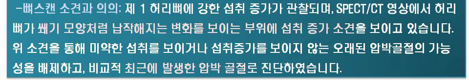 뼈스캔소견과의의:제1허리뼈에 강한 섭취가 증가가 관찰되며,SPECT/CT영상에서 허리뼈가 쐐기 모양처럼 납작해지는 변화를 보이는 부위에 섭취증가 소견을 보이고 있습니다.위 소견을 통해 미약한 섭취를 보이거나 섭취증가를 보이지 않는 오래된 압박골절의 기능성을 배제하고, 비교적 최근에 발생한 압박 골절로 진단하였습니다.