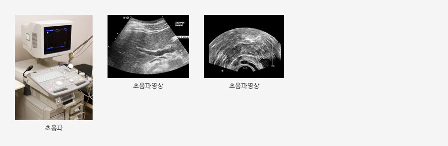 초음파 장비 관련 사진