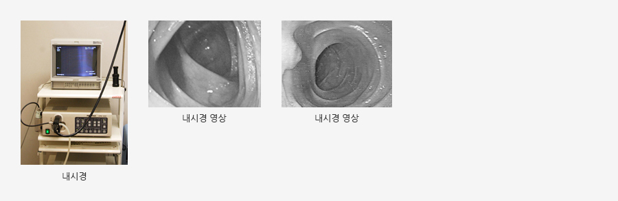 내시경 장비 관련 사진