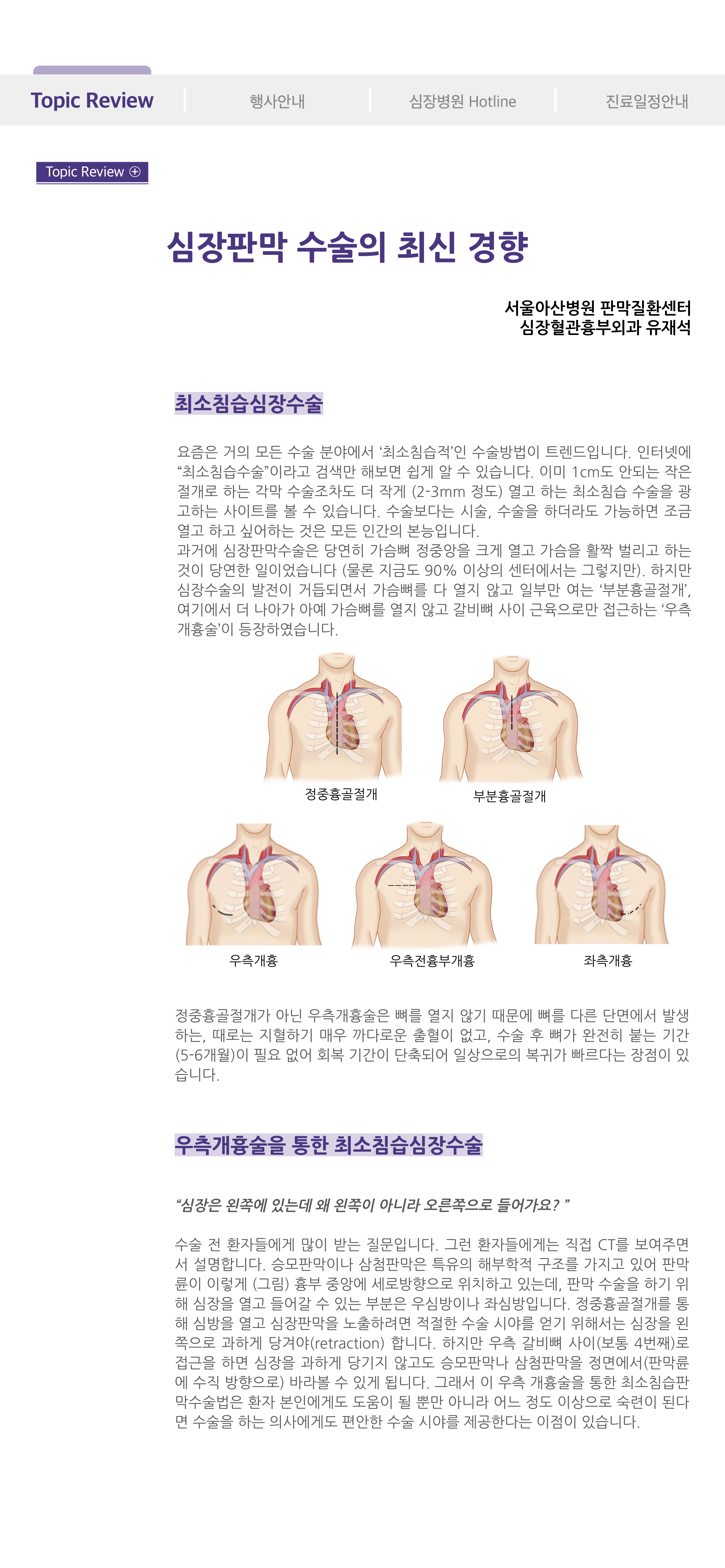 Cardiovascular Disease Update 2024년 여름호 (통권 제70호) 심장판막 수술의 최신 경향 이미지